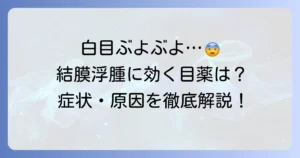 結膜浮腫におすすめの市販目薬を厳選紹介！症状を和らげる選び方と対処法